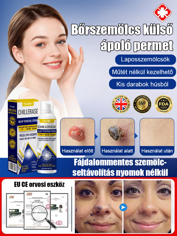 Bőrszemölcs külső ápoló permet