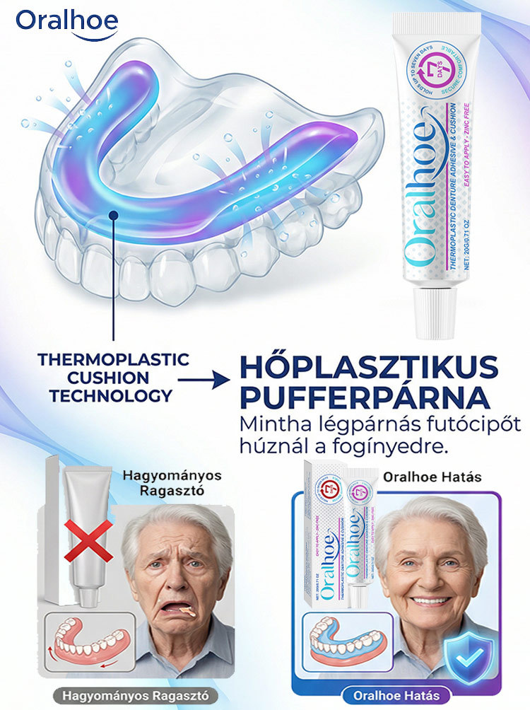 ✨ÉlelmiszeripariHőre Lágyuló Fogsor Rögzítő - 5 perc a stabil fogsorért