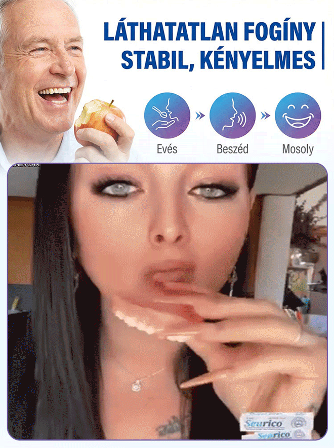 ✨ÉlelmiszeripariHőre Lágyuló Fogsor Rögzítő - 5 perc a stabil fogsorért