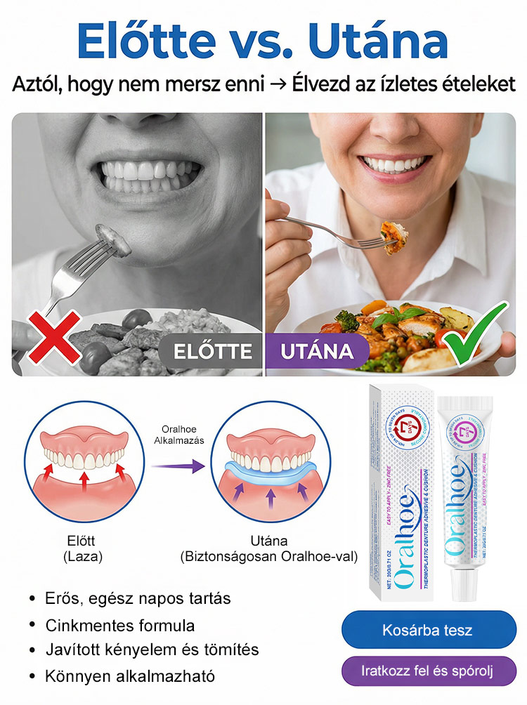 ✨ÉlelmiszeripariHőre Lágyuló Fogsor Rögzítő - 5 perc a stabil fogsorért