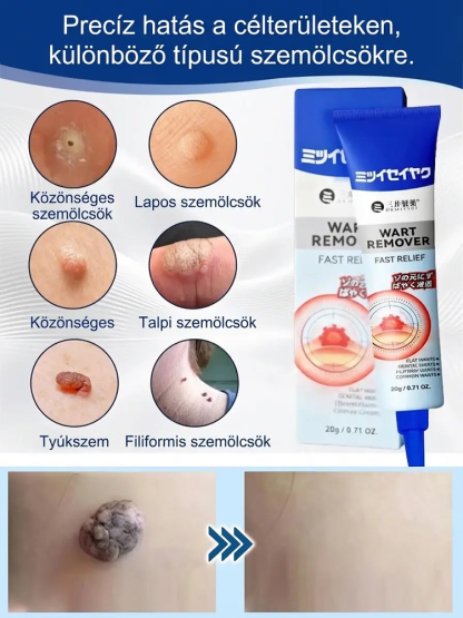 ⏱️ 3 másodperc hatás: a formula azonnal behatol a bőr mélyére!