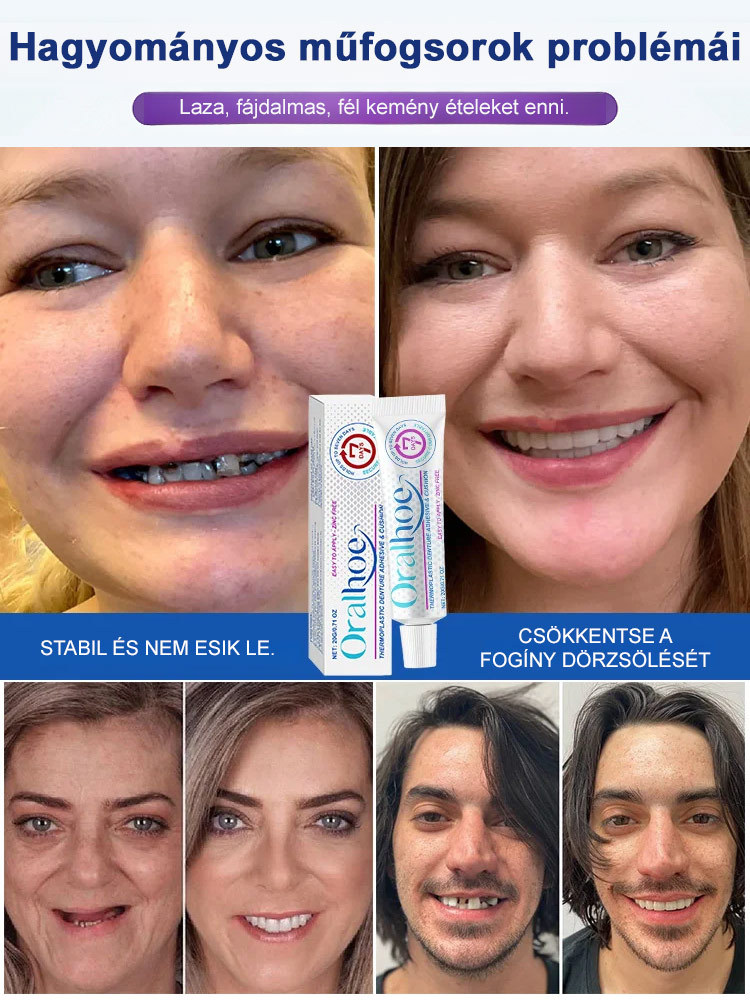 ✨ÉlelmiszeripariHőre Lágyuló Fogsor Rögzítő - 5 perc a stabil fogsorért