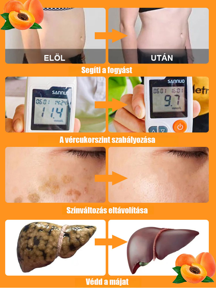 ✨"Természetes inzulinnak" hívják őket. ✨ Ezek kiváló minőségű sárgabarackok Kitsey-ből.