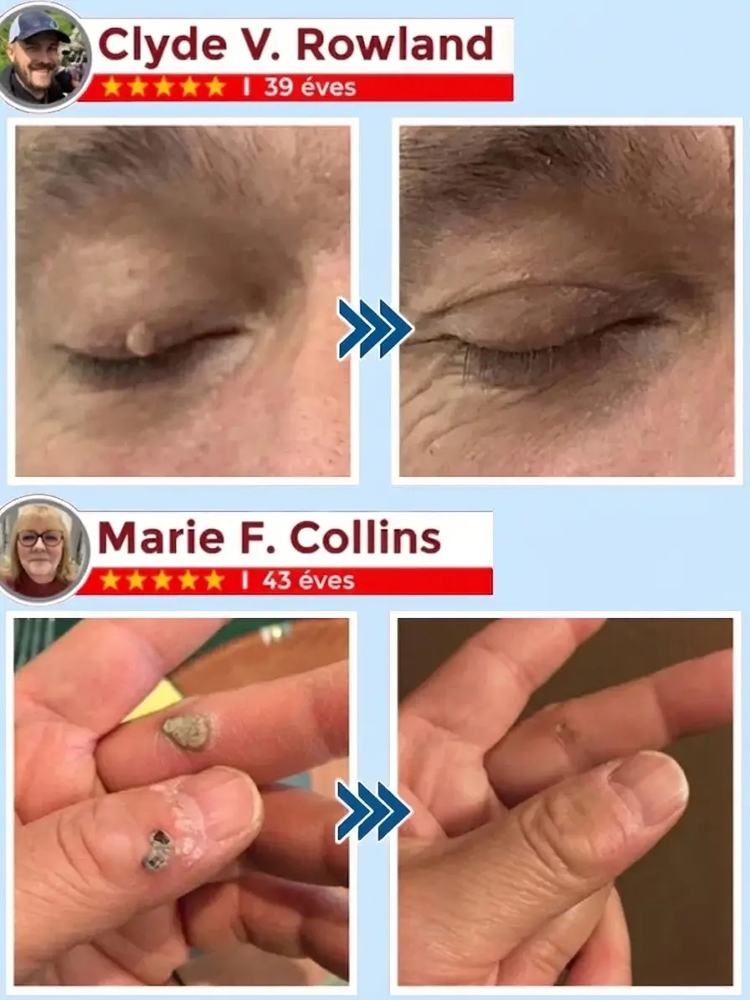 ⏱️ 3 másodperc hatás: a formula azonnal behatol a bőr mélyére!