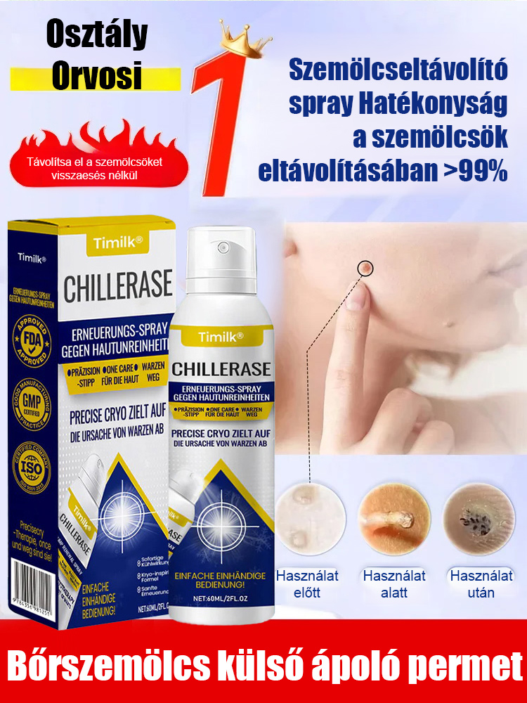 Bőrszemölcs külső ápoló permet