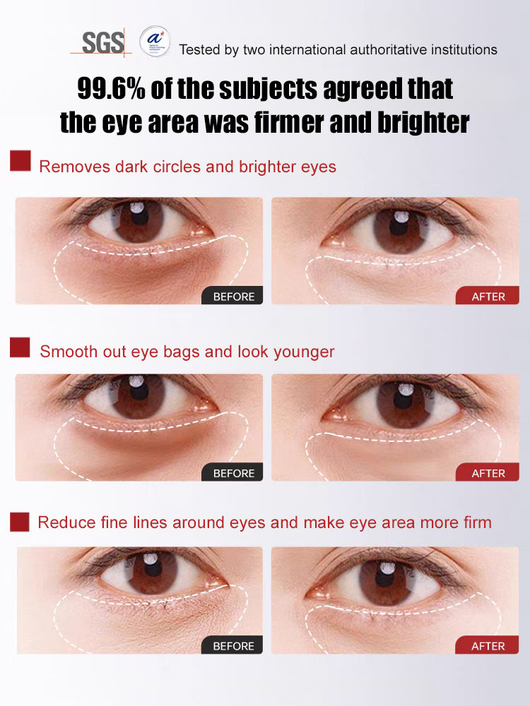 Herbal Anti-Wrinkle Firming Eye Cream✨ Say goodbye to stubborn wrinkles and eye bags👀! See visible changes in just days.