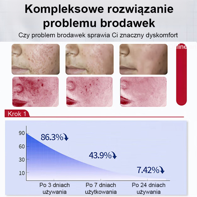 🌿Szwajcarska Maść na Kurzajki i Włókniaki | Usuwa Problem z Korzeniem w 7 Dni | Bezbolesna Formuła Medyczna CE 🔬