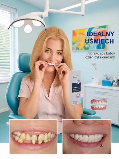  Zestaw estetycznych nakładek na zęby😁 Jedz wszystko bez obaw! Nasz zestaw nakładek pasuje idealnie, jest stabilny i daje naturalny uśmiech ✨