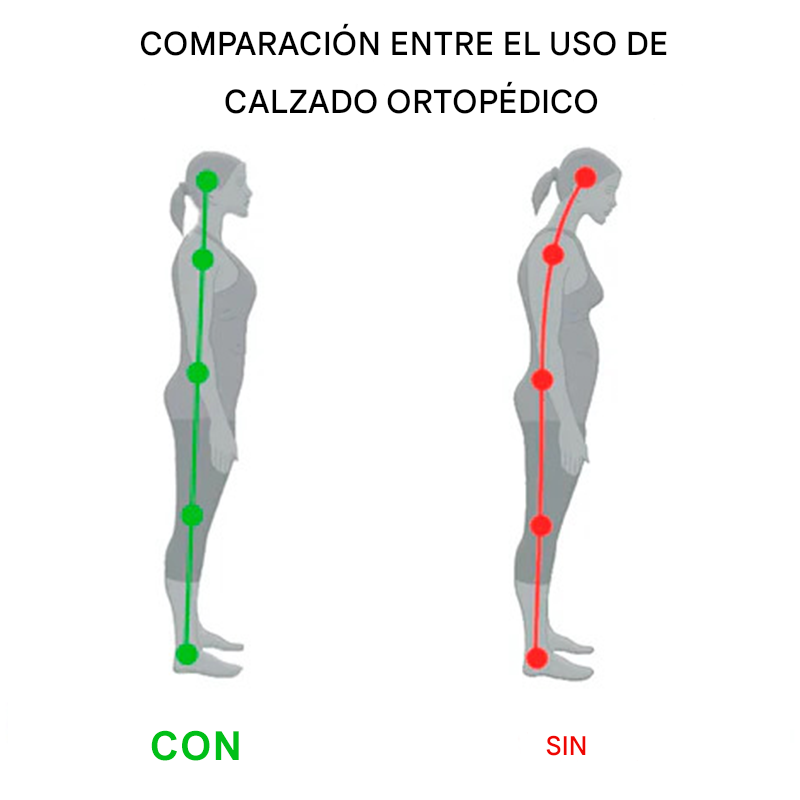 (🔥50% de descuento hoy - ¡cógelo!) Zapatos ortopédicos elegantes de primera calidad 👞 - Diseño ergonómico para aliviar el dolor