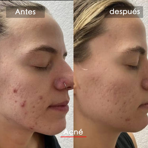 Mascarilla LED Facial Veonskin Pro - Terapia de Luz de 7 Colores para el Cuidado de la Piel