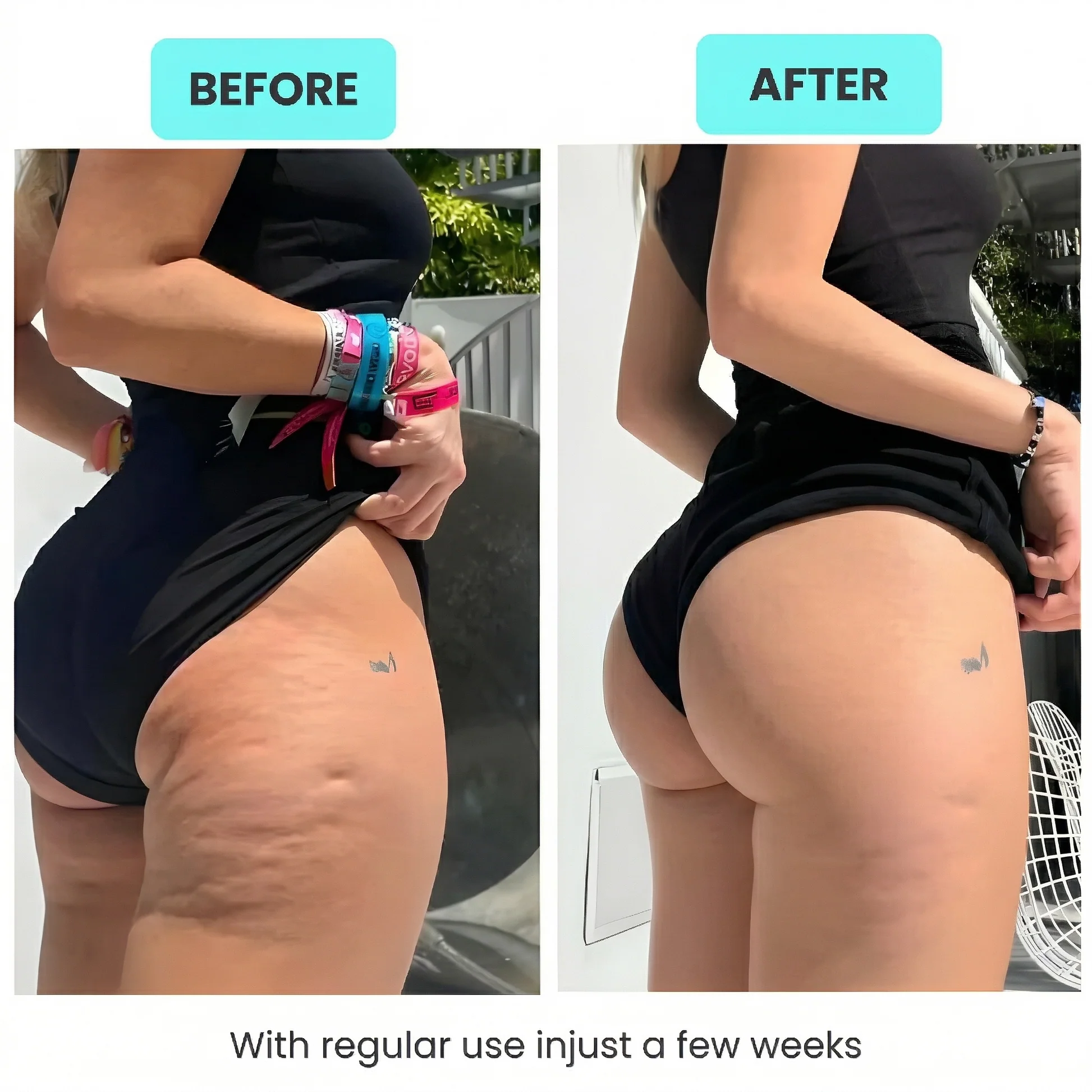 Sculpting Massage Roller – Face & Body Lymphatic Drainage Tool for Firming, Slimming & Relaxation