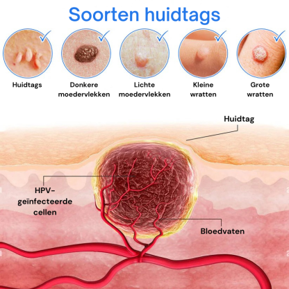 Zycon® Instant crème voor de behandeling van oneffenheden-北京欧布科技有限公司