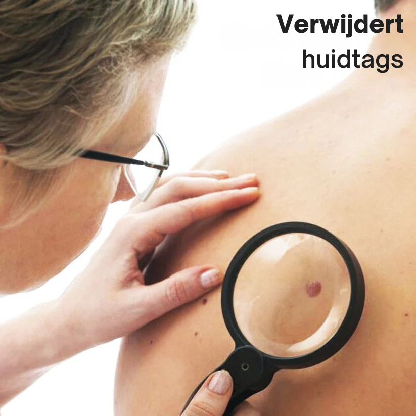 Zycon® Instant crème voor de behandeling van oneffenheden-北京欧布科技有限公司