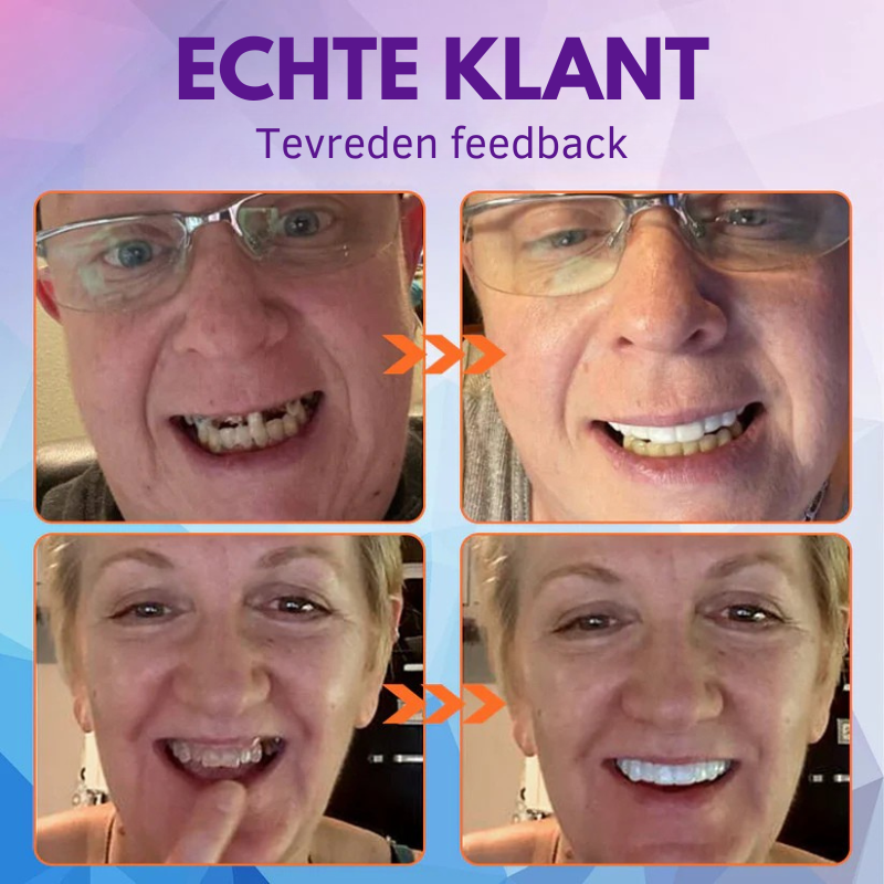 Oralhoe® Set van siliconen kunstgebitten-北京欧布科技有限公司