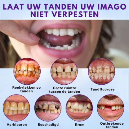 Oralhoe® Set van siliconen kunstgebitten-北京欧布科技有限公司