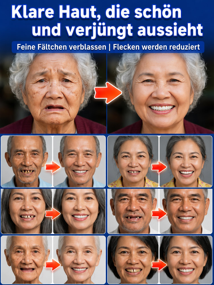 [Unsichtbar und komfortabel] Maßgefertigte voll ausgestattete medizinische Vollprothesen