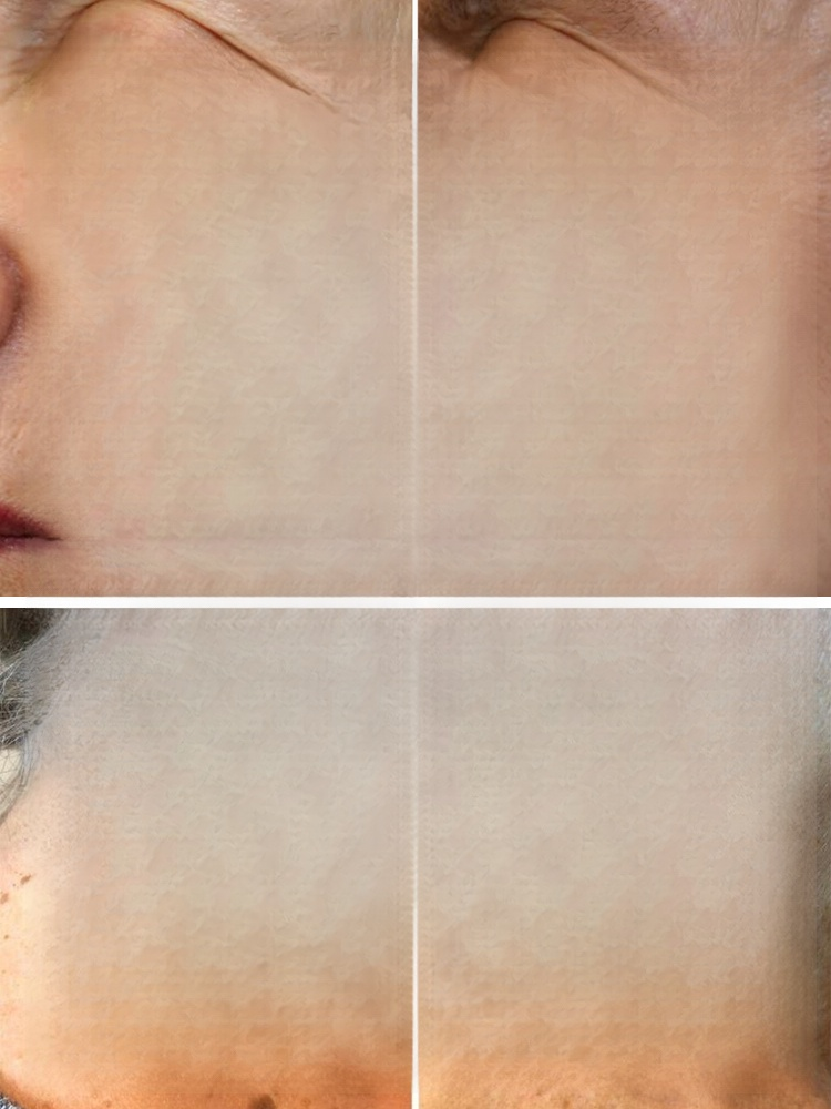 ✅ Über 1 Million zufriedene Nutzer weltweit：Bereits über eine Million Menschen vertrauen auf diese Technologie