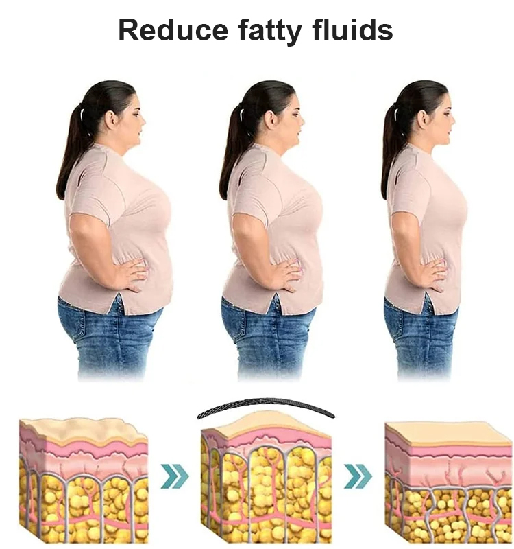 🔥Recommended by Harvard Sports Medicine Experts! Self-Heating Knee Supports with Moxa Technology 🔥 Keep Warm, Stay Active！ Incredible Value ✅