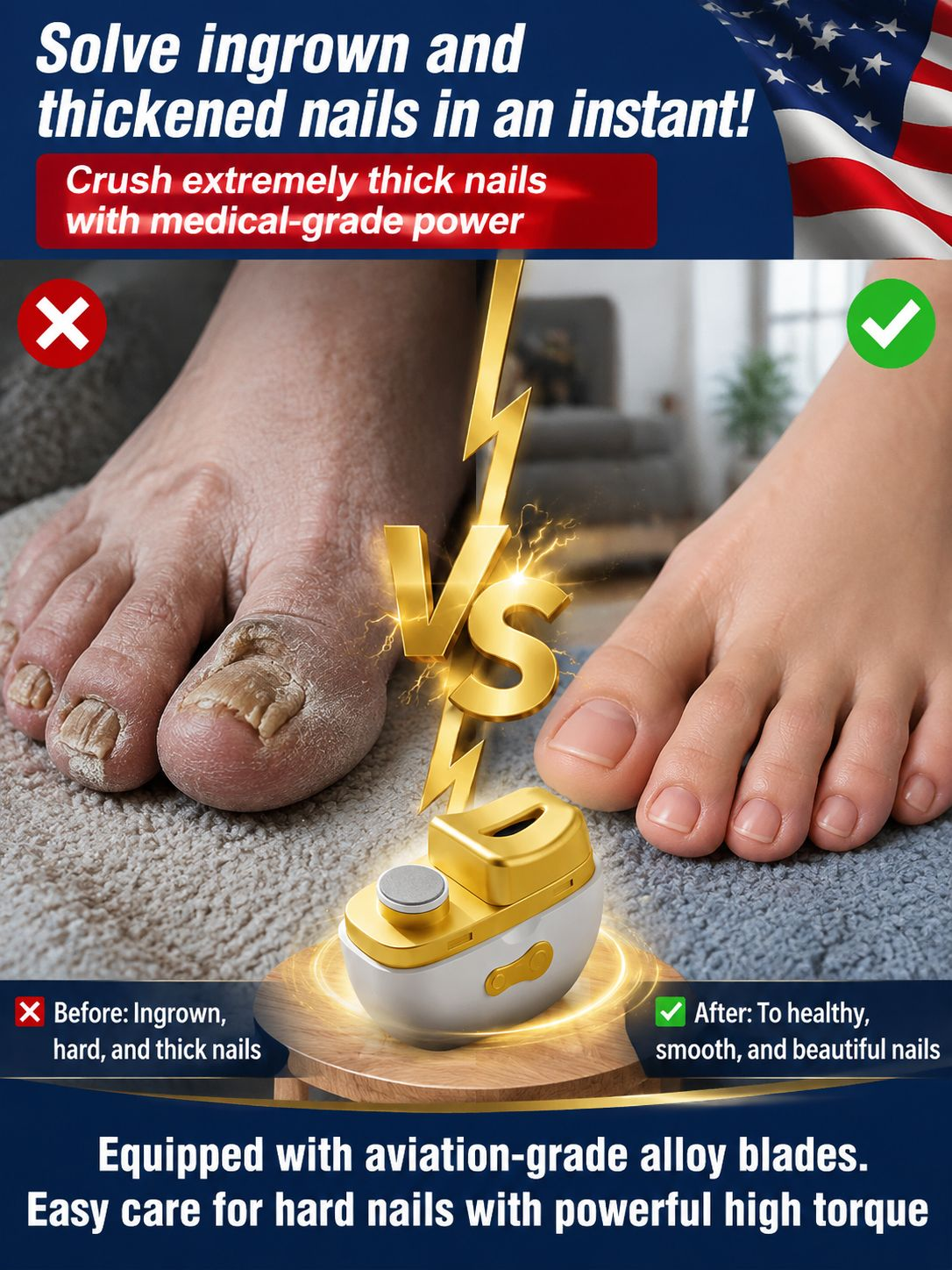 ⚡ Electric Nail Clipper: Smooth rounded nails in just 10 seconds 🚫 No more cuts or bleeding 💅