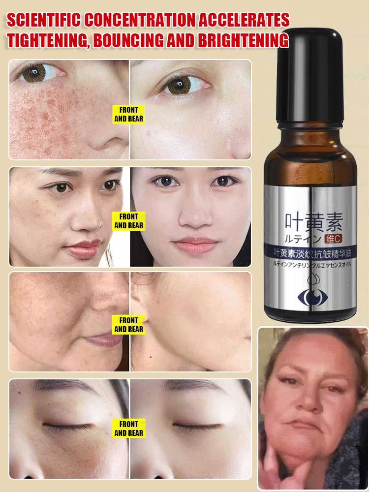 Lutein Anti-Wrinkle Essential Oil – visible improvement in under-eye fine lines in 7 days, and look 10 years younger in 14 days!