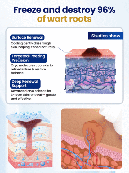 Highly recommended by authoritative dermatology experts, suitable for all skin types, with no side effects.