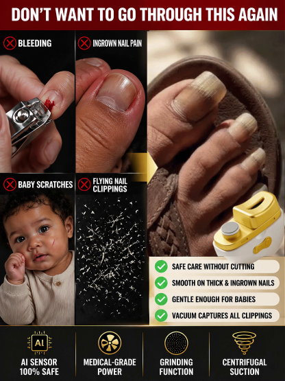 ⚡ Electric Nail Clipper: Smooth rounded nails in just 10 seconds 🚫 No more cuts or bleeding 💅