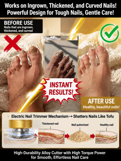 ⚡ Electric Nail Clipper: Smooth rounded nails in just 10 seconds 🚫 No more cuts or bleeding 💅