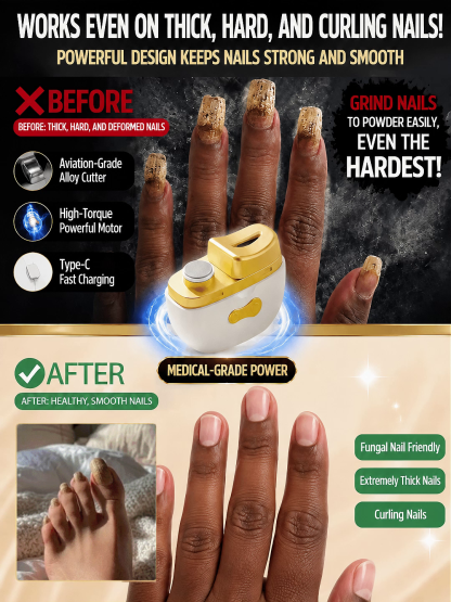 ⚡ Electric Nail Clipper: Smooth rounded nails in just 10 seconds 🚫 No more cuts or bleeding 💅