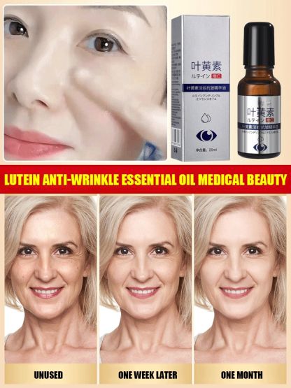 Lutein Anti-Wrinkle Essential Oil – visible improvement in under-eye fine lines in 7 days, and look 10 years younger in 14 days!
