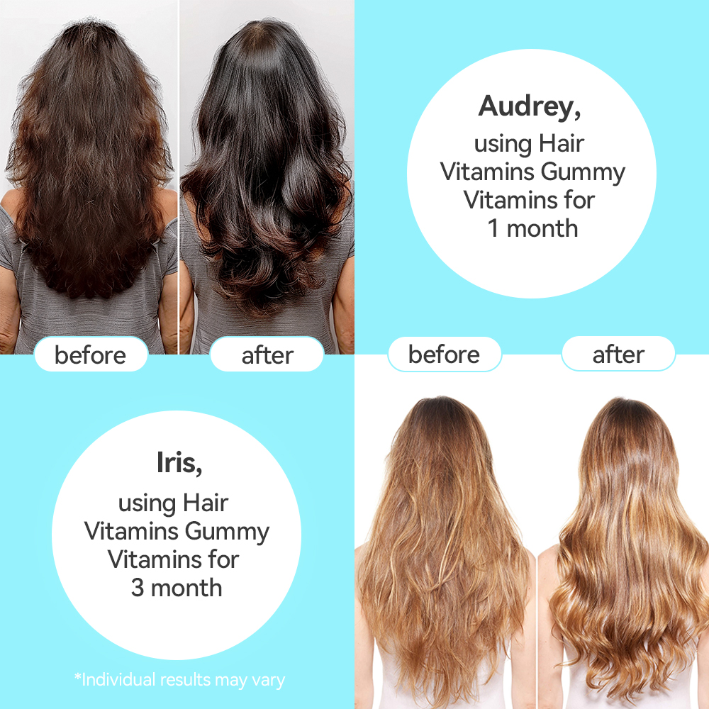 Hair Vitamin Gummy 2 Month Supply Extra Strength Biotin 6000mcg Growth for Men & Women Vegan B12 MSM Inositol Omega 3 Elderberry Kosher Halal Cruelty-Free 60 Gummies