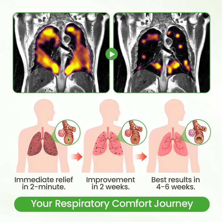 Timilk® HerbaAir Mullein Lung Purifier