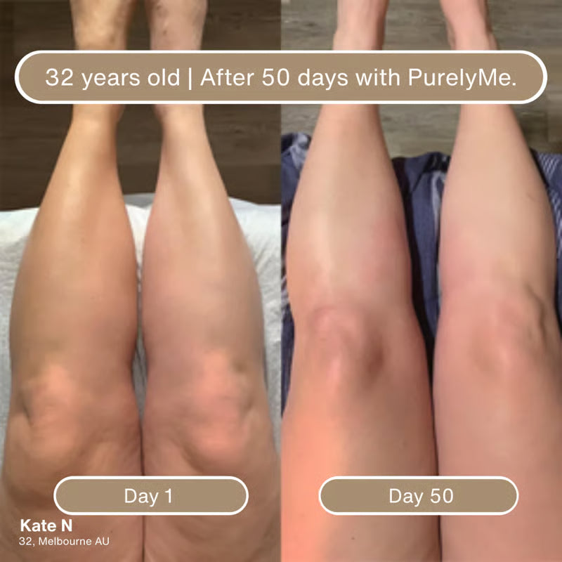 🏆Big Promotion Event⚡ 50,000 loved by customers - Deep Hydration & Firming Body Oil for Smooth, Supple Skin