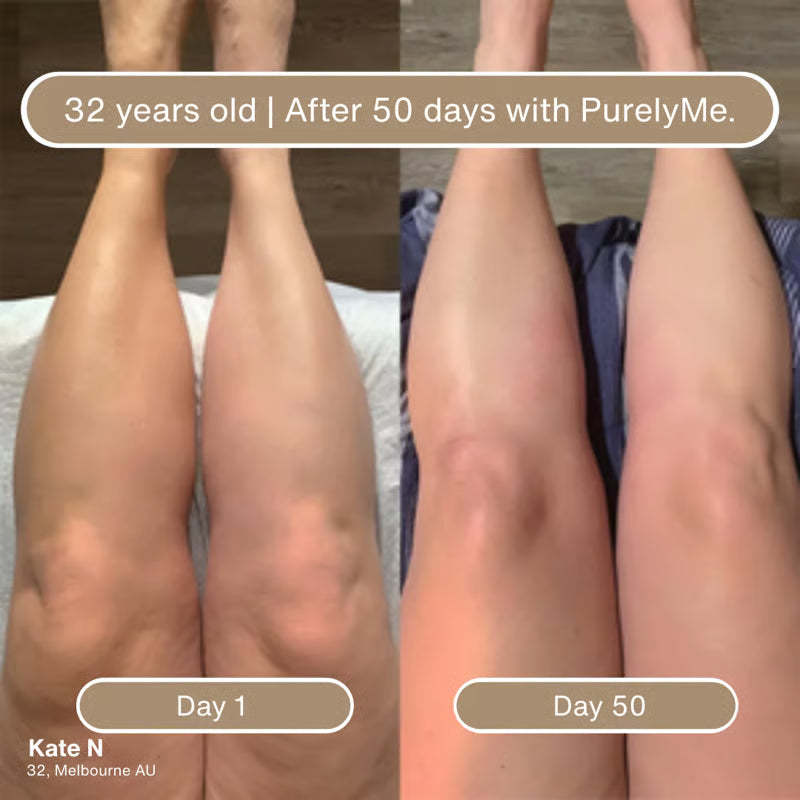 🏆Big Promotion Event⚡ 50,000 loved by customers - Deep Hydration & Firming Body Oil for Smooth, Supple Skin