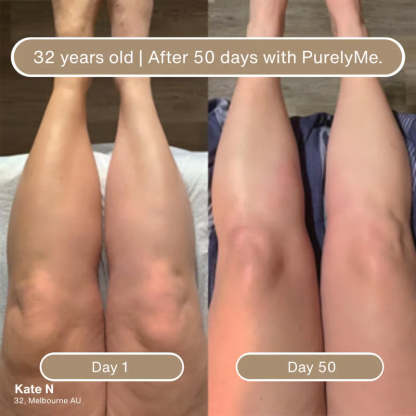 🏆Big Promotion Event⚡ 50,000 loved by customers - Deep Hydration & Firming Body Oil for Smooth, Supple Skin