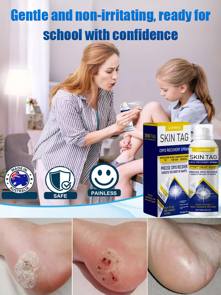 【Say Goodbye to Warts】LANISKA Wart Care Topical Spray