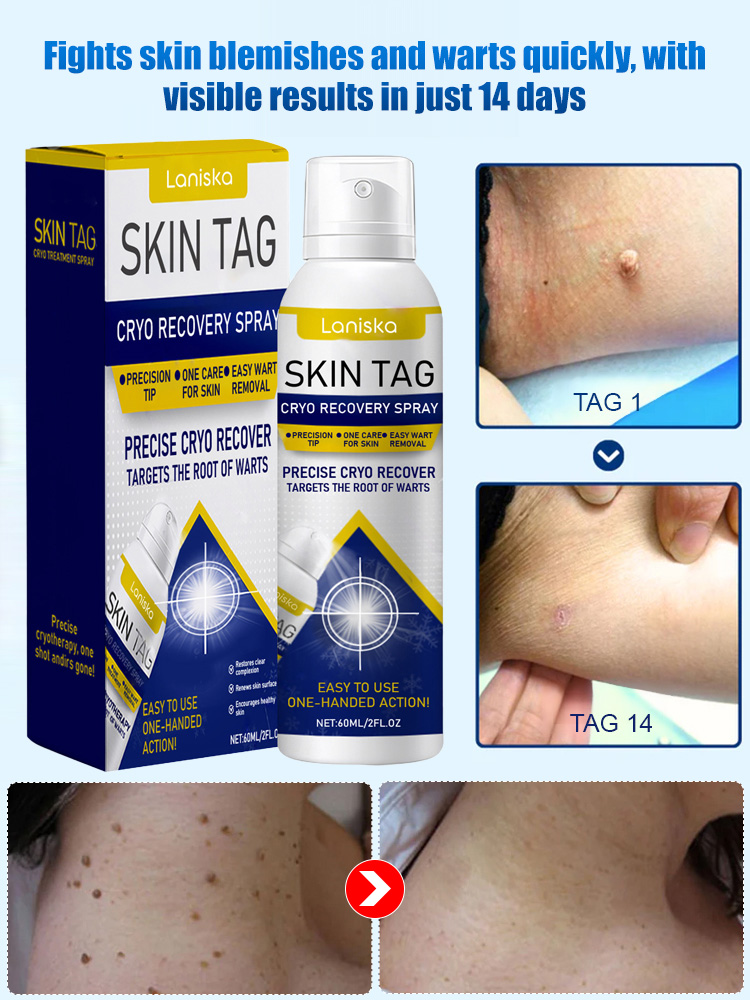 【Say Goodbye to Warts】LANISKA Wart Care Topical Spray