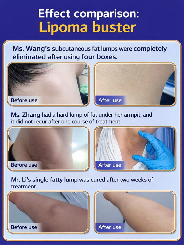  [Instant Effect] Fat Care Balm