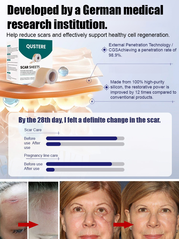 24-hour continuous light scar silicone gel scar patch