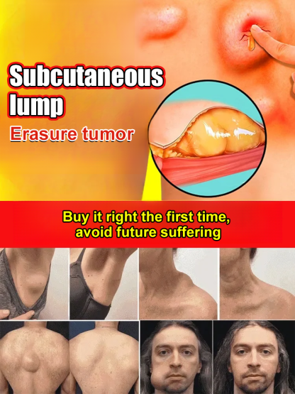  [Instant Effect] Fat Care Balm