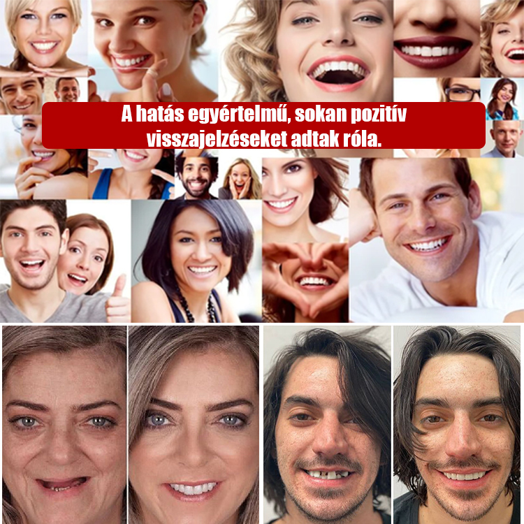 Élvezd a rágást aggodalom nélkül! 🦷 Amerikai csontszerkezet-támogató technológia 🔥 Szerezd vissza a fiatalkor harapóerejét!