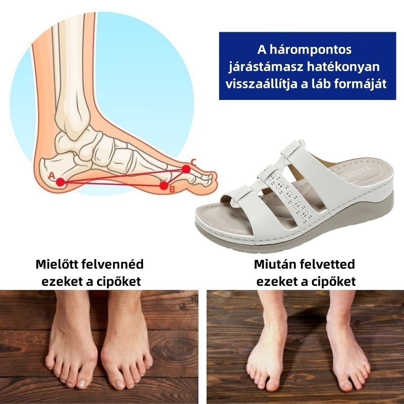 [🎁 Mai ajánlat: Féláron — Vásárolj most!]Női nyári ortopéd szandálok —Mondj búcsút a fájdalomnak, sétálj könnyedén 👞Tapasztald meg a tökéletes kényelmet!
