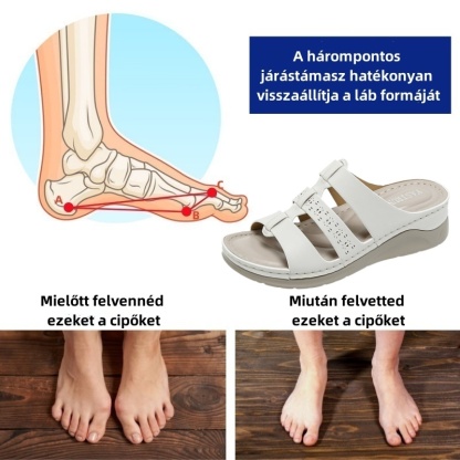 [🎁 Mai ajánlat: Féláron — Vásárolj most!]Női nyári ortopéd szandálok —Mondj búcsút a fájdalomnak, sétálj könnyedén 👞Tapasztald meg a tökéletes kényelmet!