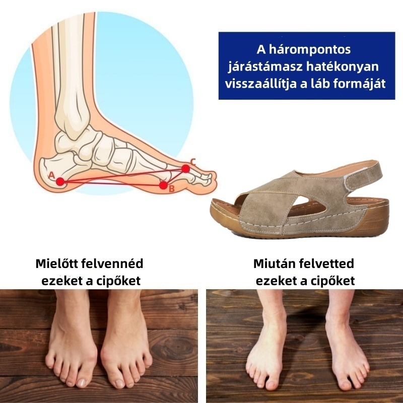 🔥 Korlátozott ideig 50% kedvezmény!Nyári ortopédiai szandálokErgonomikus kialakítás ✅ Fájdalommentes járás minden lépésben