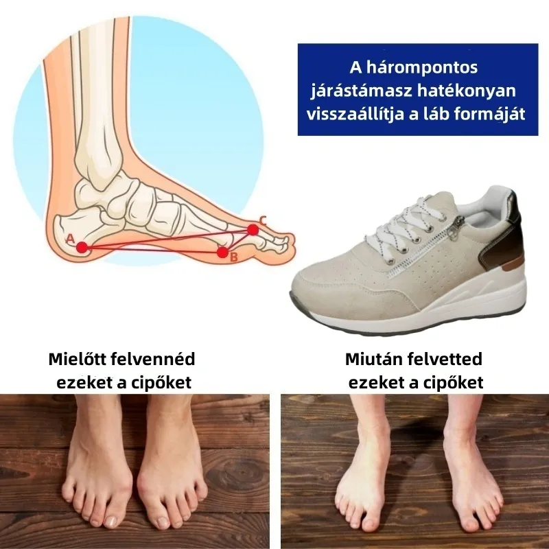 🎁Újévi különleges ajánlat - Spóroljon 67%-ot - Női ortopéd cipők, velúrból, enyhítik a fáradtságot, kényelmesek és könnyűek 🥳