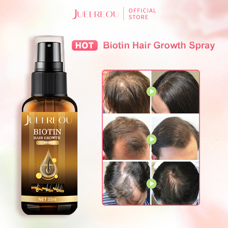 Biotin Hair Growth Spray