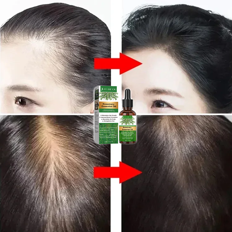 Rosemary Hair Growth Essential Oil