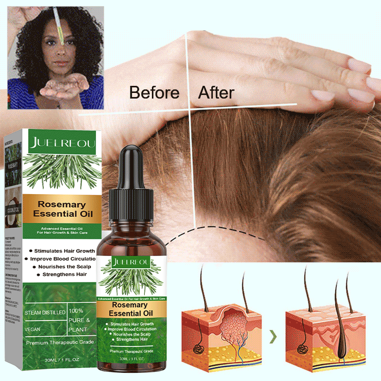 Rosemary Hair Growth Essential Oil