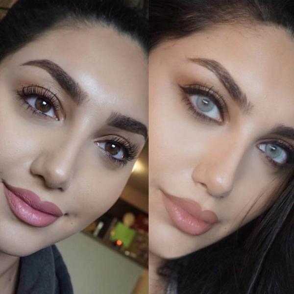 Hidrocor Quartz | 1 Year [Prescription]