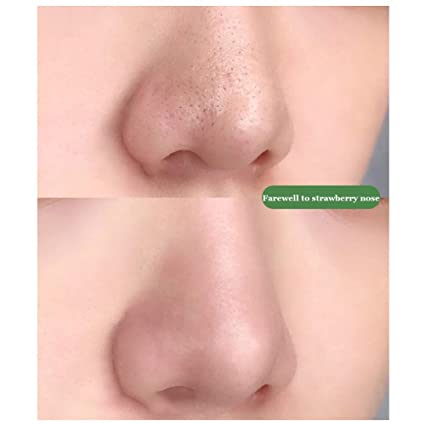 Green Tea Face Cleansing Mask Anti Acne & Blackhead