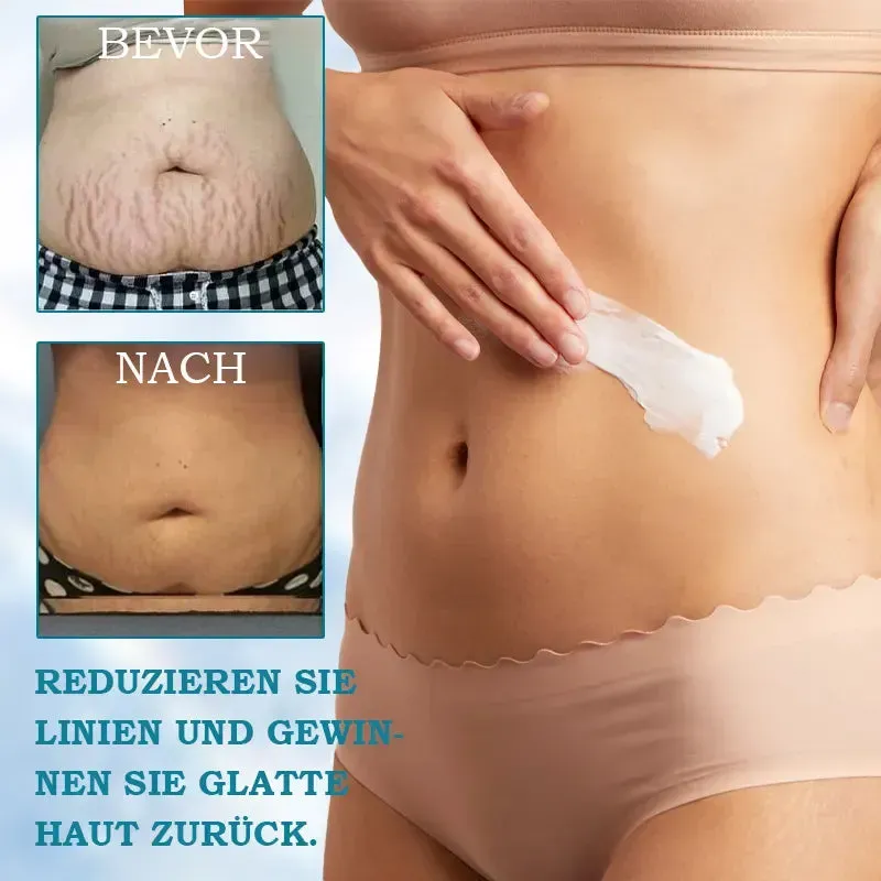 💥💥Last Day Discount: 87% 0FF💥 Poiultd@ Advanced Firming & Wrinkle-Reducing Cream: Restore skin elasticity 